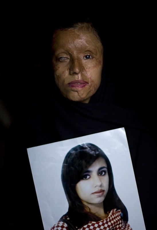 Violencia de género en Pakistán, de Emilio Morenatti